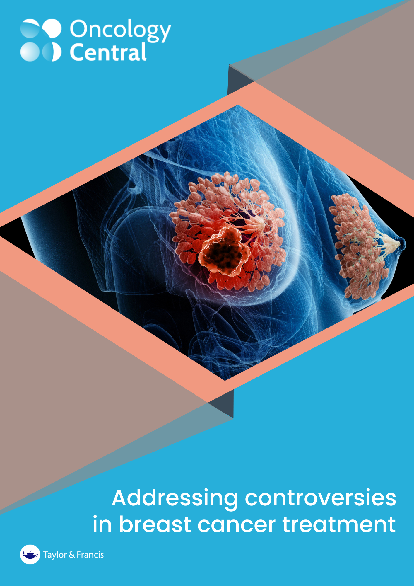 Addressing controversies in breast cancer treatment - eBook CoverBack  (1)
